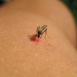 Lampă insecticidă anti țânțari, muște, insecte zburătoare, Profi, 70 de mp, Gardigo Lampă insecticidă anti țânțari, muște, insecte zburătoare, Profi, 70 de mp, Gardigo